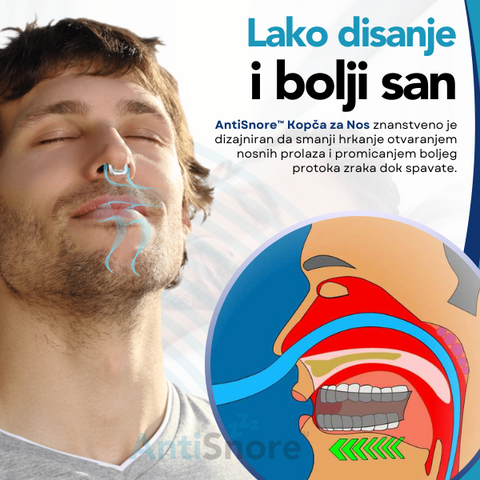 AntiSnore™ Kopča za Nos