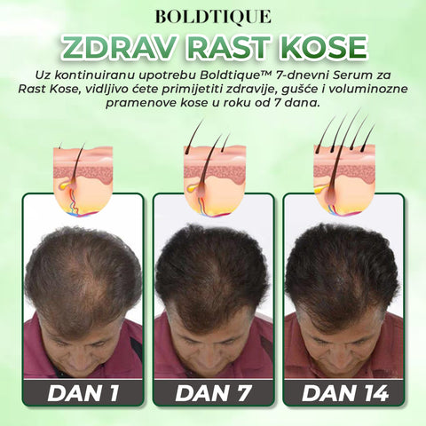 Boldtique™ 7-dnevni Serum za Rast Kose