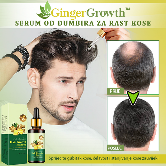 GingerGrowth™ Serum od Đumbira za Rast Kose