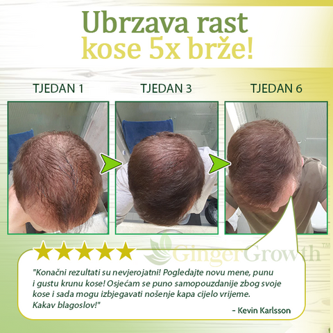 GingerGrowth™ Serum od Đumbira za Rast Kose