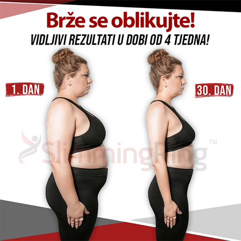SlimmingRing™