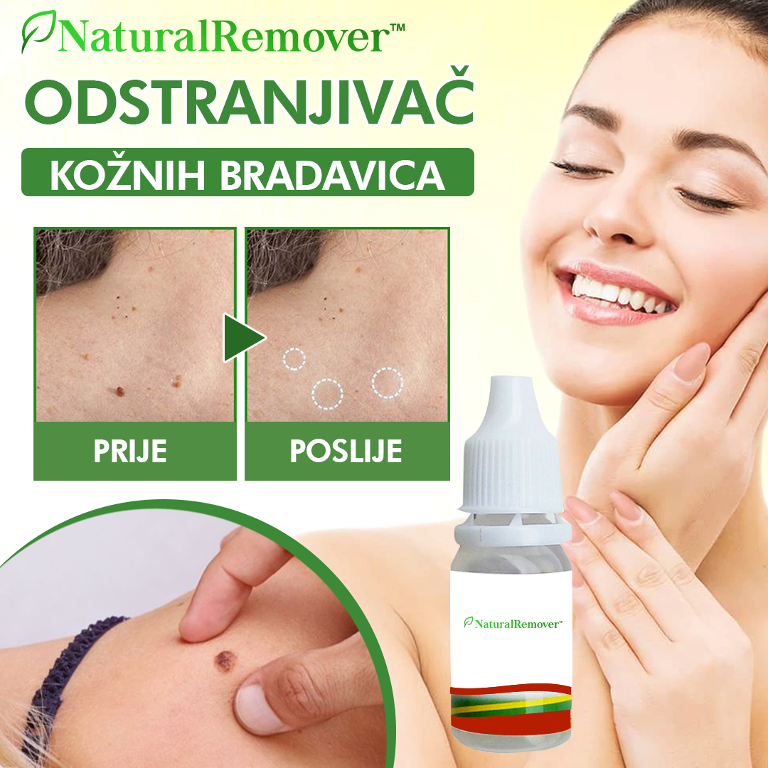 NaturalRemover™ Odstranjivač Kožnih Bradavica