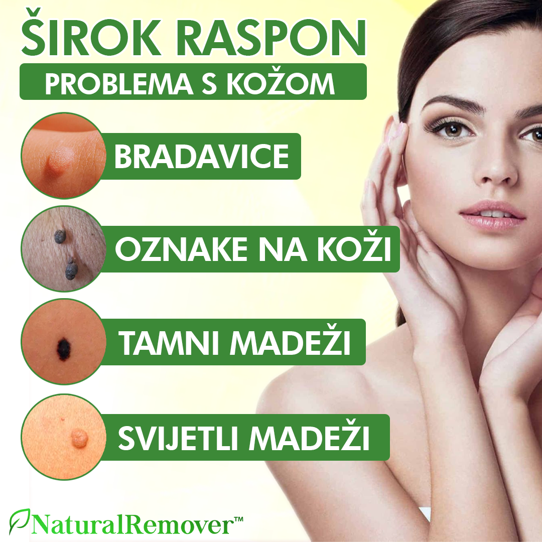 NaturalRemover™ Odstranjivač Kožnih Bradavica