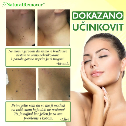 NaturalRemover™ Odstranjivač Kožnih Bradavica