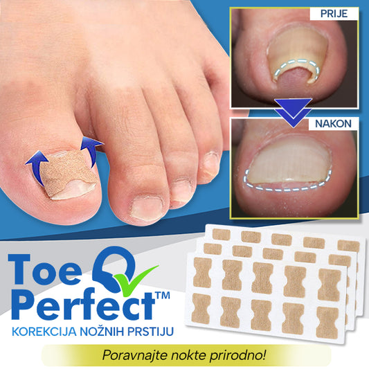ToePerfect™ Korekcija Nožnih Prstiju